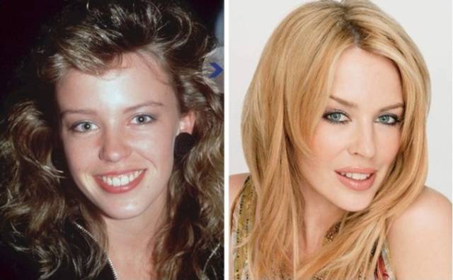priceless_photos_showing_how_celebs_looked_back_in_the_day_640_16