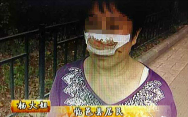 A kínai nő orrát férje leharapta, majd le is nyelte. 
