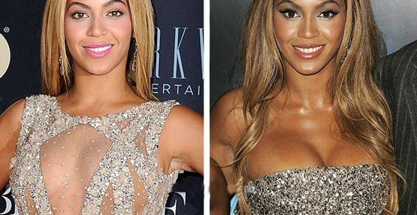 beyonce-plastic-surgery-pictures