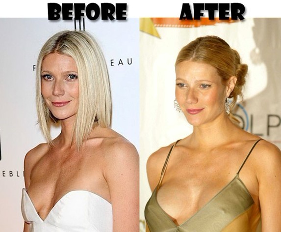 gywneth-paltrow-boob-job-before-and-after