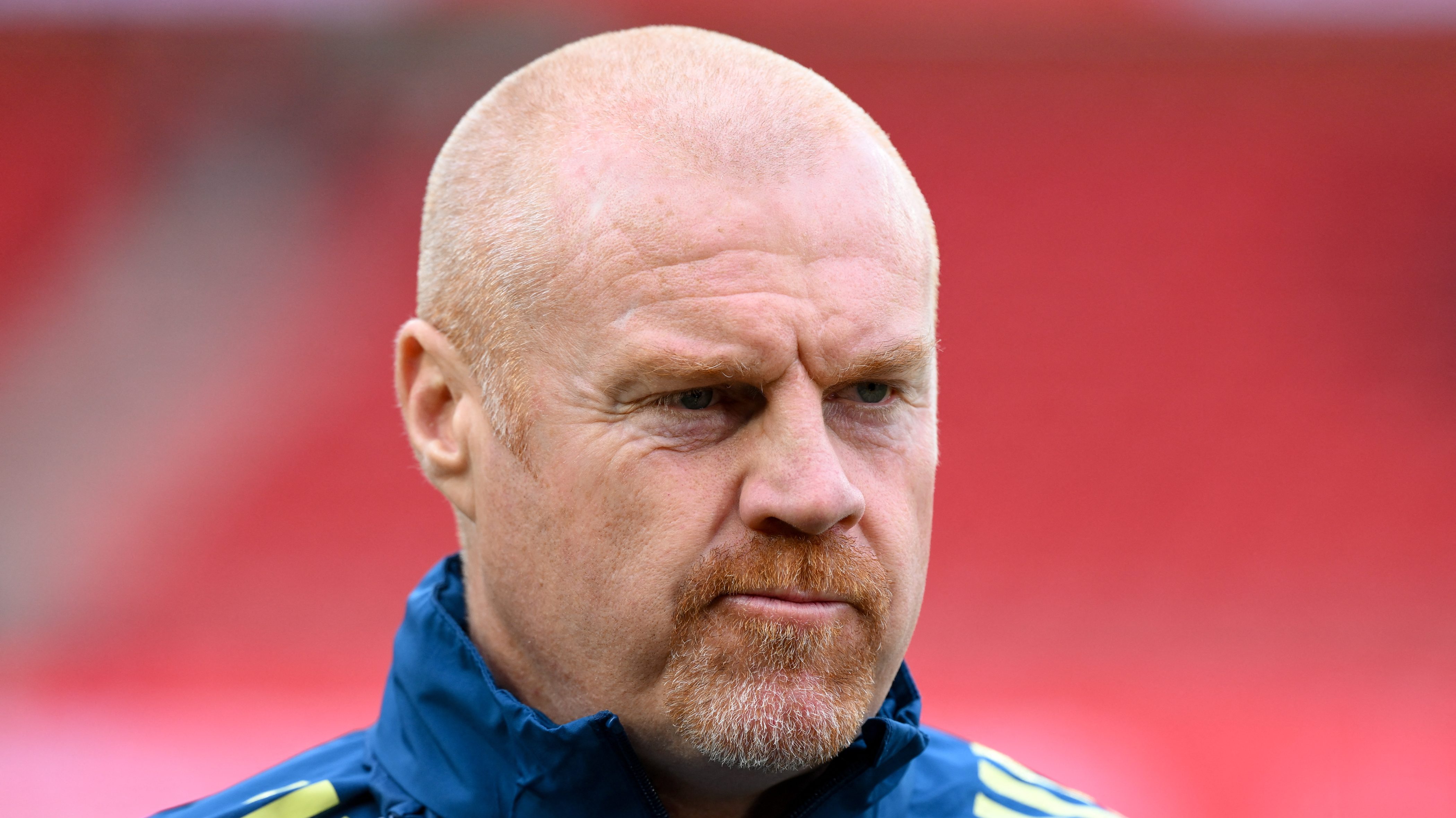 Sean Dyche.